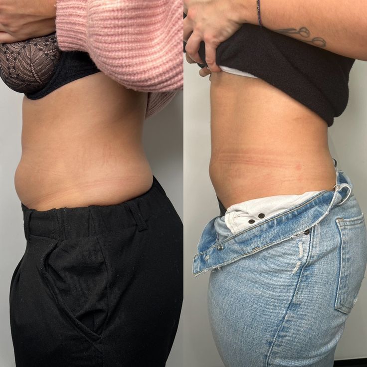 LOTO LIMPIA TU SISTEMA LINFATICO